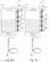 Fig. 17 - MODULAR DOSING ASSEMBLY OF MEDICAL SUBSTANCES