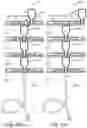 Fig. 66 - MODULAR DOSING ASSEMBLY OF MEDICAL SUBSTANCES