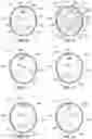 Fig. 08 - PORTABLE MEDICINE STORING AND DISPENSING APPARATUS AND METHODS
