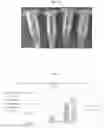 Fig. 12 - STABLE MACROEMULSION FOR ORAL DELIVERY OF SOLUBILIZED PEPTIDES, PROTEIN, AND CELLULAR THERAPEUTICS