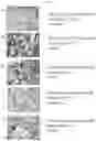 Fig. 19 - STABLE MACROEMULSION FOR ORAL DELIVERY OF SOLUBILIZED PEPTIDES, PROTEIN, AND CELLULAR THERAPEUTICS