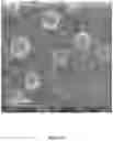 Fig. 12 - Liposomal particles, methods of making same and uses thereof