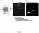 Fig. 14 - Liposomal particles, methods of making same and uses thereof