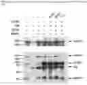 Fig. 17 - Metformin glycinate, pharmaceutical compositions comprising the same, and methods of using the same