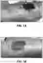 Fig. 02 - TOPICAL FORMULATION FOR TREATING BRUISING