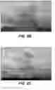 Fig. 04 - TOPICAL FORMULATION FOR TREATING BRUISING