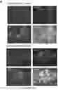Fig. 23 - Method of treating a methionine-dependent cancer