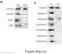 Fig. 44 - Method of treating a methionine-dependent cancer