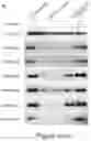 Fig. 46 - Method of treating a methionine-dependent cancer
