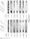 Fig. 47 - Method of treating a methionine-dependent cancer