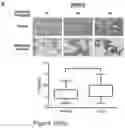 Fig. 50 - Method of treating a methionine-dependent cancer