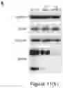 Fig. 60 - Method of treating a methionine-dependent cancer