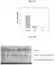 Fig. 16 - ORAL ANTICANCER PRODRUGS, THEIR PREPARATION METHODS AND APPLICATIONS