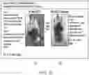 Fig. 74 - Compositions and methods for CAR T cell therapy