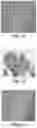 Fig. 07 - Methods for production of platelets from pluripotent stem cells and compositions thereof