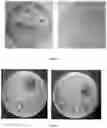 Fig. 03 - COLLAGEN MEMBRANE OR MATRIX WITH ANTIMICROBIAL PROPERTIES