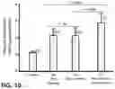 Fig. 09 - Method of treating Bruch's membrane hypofunction disease