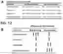 Fig. 11 - Method of treating Bruch's membrane hypofunction disease