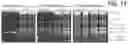 Fig. 13 - Method of treating Bruch's membrane hypofunction disease