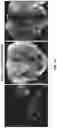 Fig. 04 - MODULATION OF GUT MICROBIOTA IN HUNTINGTON'S DISEASE AND RETT SYNDROME