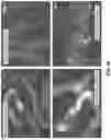 Fig. 23 - MODULATION OF GUT MICROBIOTA IN HUNTINGTON'S DISEASE AND RETT SYNDROME