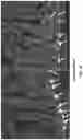 Fig. 30 - MODULATION OF GUT MICROBIOTA IN HUNTINGTON'S DISEASE AND RETT SYNDROME