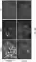 Fig. 45 - MODULATION OF GUT MICROBIOTA IN HUNTINGTON'S DISEASE AND RETT SYNDROME