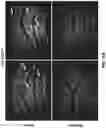 Fig. 46 - MODULATION OF GUT MICROBIOTA IN HUNTINGTON'S DISEASE AND RETT SYNDROME