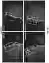 Fig. 55 - MODULATION OF GUT MICROBIOTA IN HUNTINGTON'S DISEASE AND RETT SYNDROME