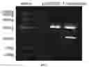 Fig. 02 - Applications of genetically engineered bacteria VNP20009-M in preparation of drugs for preventing and treating lung cancer