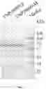 Fig. 03 - Applications of genetically engineered bacteria VNP20009-M in preparation of drugs for preventing and treating lung cancer