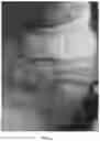 Fig. 07 - Applications of genetically engineered bacteria VNP20009-M in preparation of drugs for preventing and treating lung cancer