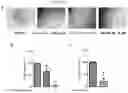 Fig. 15 - Methods and compositions for treating non-small cell lung cancer