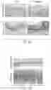 Fig. 12 - PTD-SMAD7 THERAPEUTICS