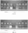 Fig. 07 - Pharmaceutical composition comprising plasminogen and uses thereof