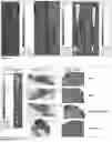 Fig. 10 - COMPOSITIONS AND METHOD FOR THE TREATMENT AND DETECTION OF COLON CANCER
