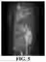 Fig. 07 - TINY NANOPARTICLES FOR MAGNETIC RESONANCE IMAGING APPLICATIONS