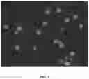 Fig. 04 - Compositions and associated methods for radioisotope-binding microparticles