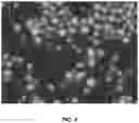Fig. 05 - Compositions and associated methods for radioisotope-binding microparticles