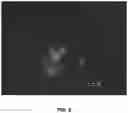 Fig. 07 - Compositions and associated methods for radioisotope-binding microparticles