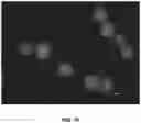 Fig. 11 - Compositions and associated methods for radioisotope-binding microparticles