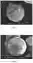 Fig. 06 - Microsphere and preparation method thereof
