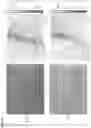 Fig. 05 - Adhesive for hard tissue bonding, adhesive kit for hard tissue bonding, and bone cement