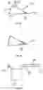 Fig. 12 - DEVICES AND METHODS FOR WOUND TREATMENT