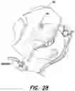 Fig. 15 - DEVICES AND METHODS FOR WOUND TREATMENT