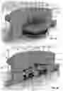 Fig. 05 - Blood pump system for causing persistent increase in the overall diameter of a target vessel
