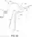 Fig. 32 - Blood pump system for causing persistent increase in the overall diameter of a target vessel