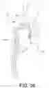 Fig. 44 - Blood pump system for causing persistent increase in the overall diameter of a target vessel