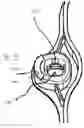 Fig. 03 - Fluid cassette with alignment latching having an improved tilt-tolerance as well as a blood treatment apparatus