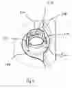 Fig. 08 - Fluid cassette with alignment latching having an improved tilt-tolerance as well as a blood treatment apparatus